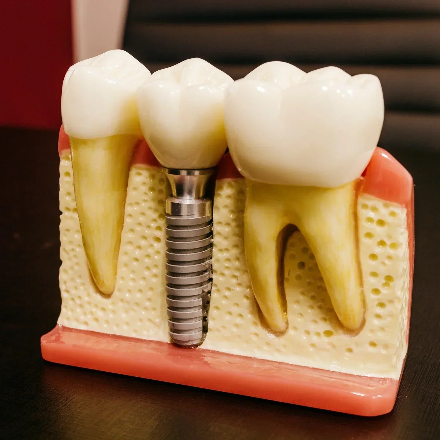 Are Zima Dental's tablets compatible with cobalt chromium dental appliances? (2026) - Dr. Jack Pinnar-Smith